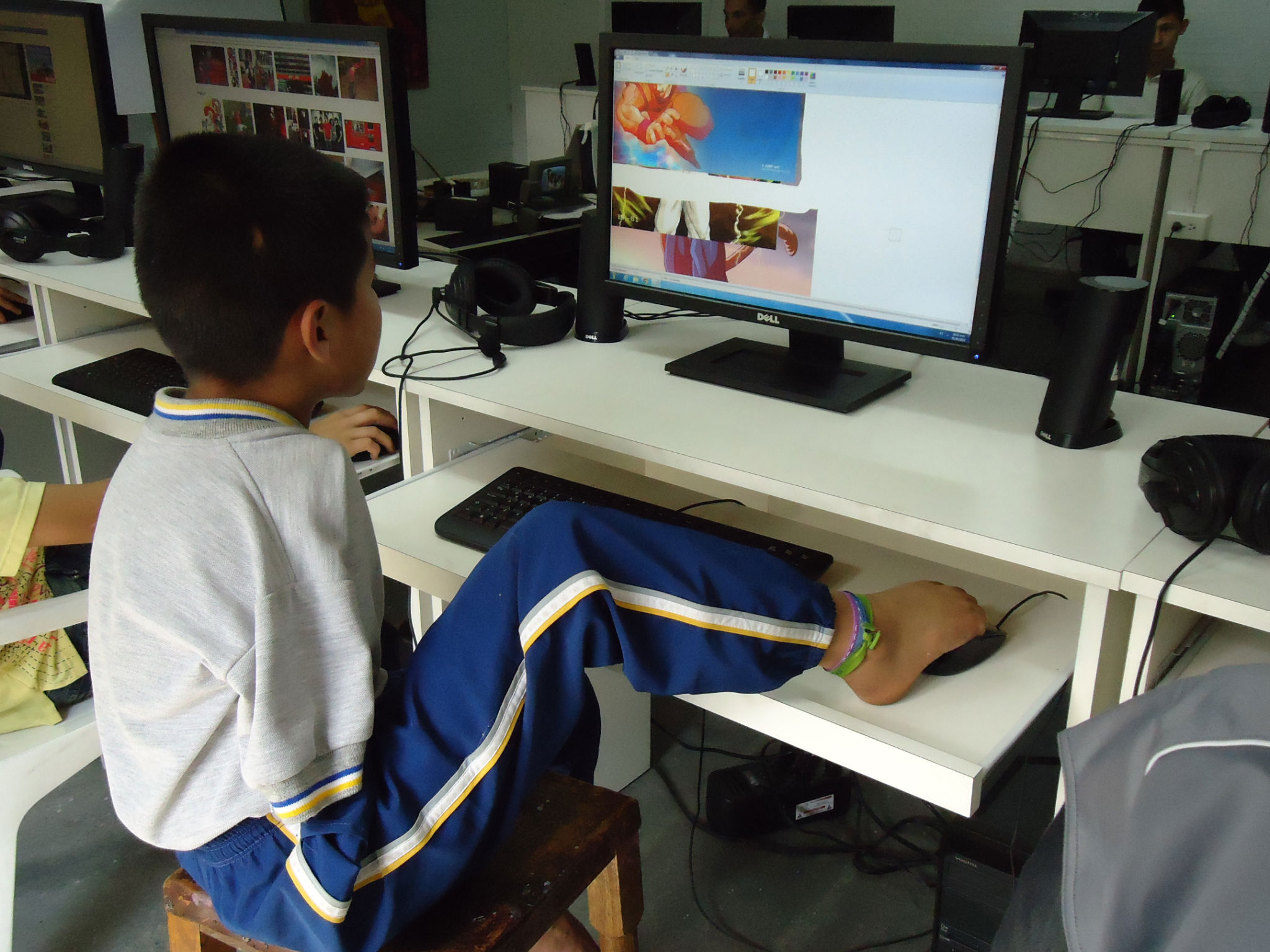 Inclusion for People with Disabilities in Colombia