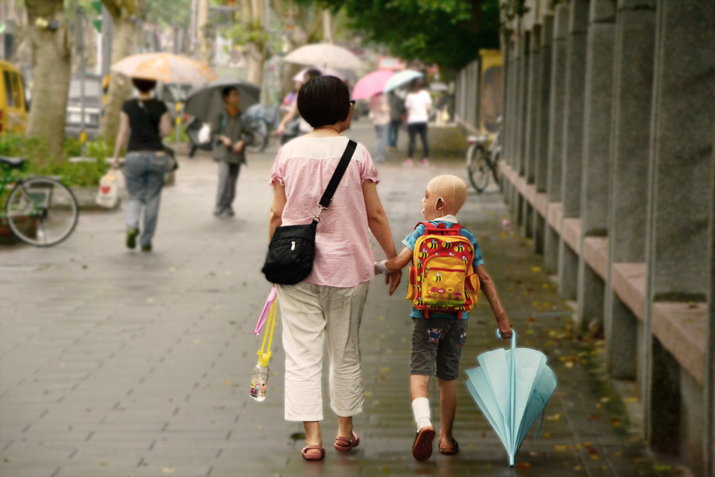 Rehabilitation for burn survivors in Taiwan