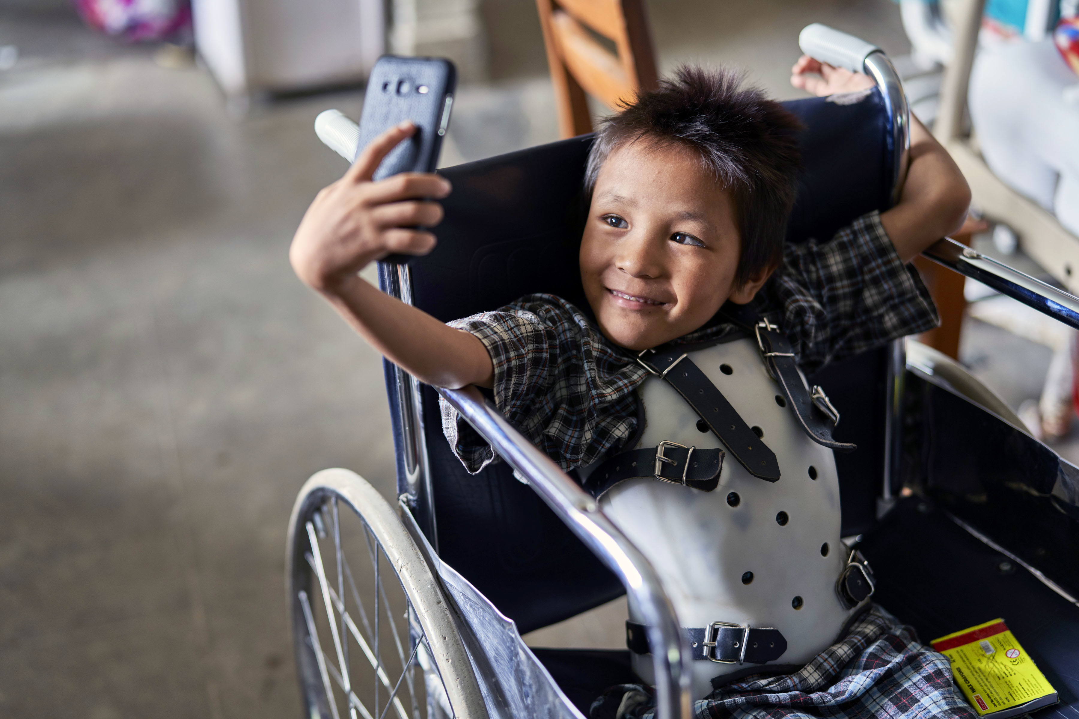 Surgery for Children with Disabilities in Nepal