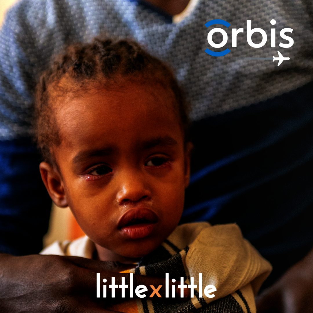 Simple Surgery to restore Sight to Ethiopians