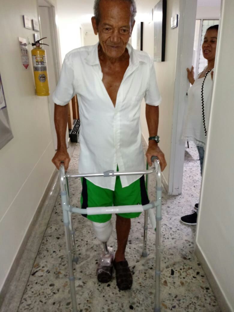 Donate and give a prosthesis!