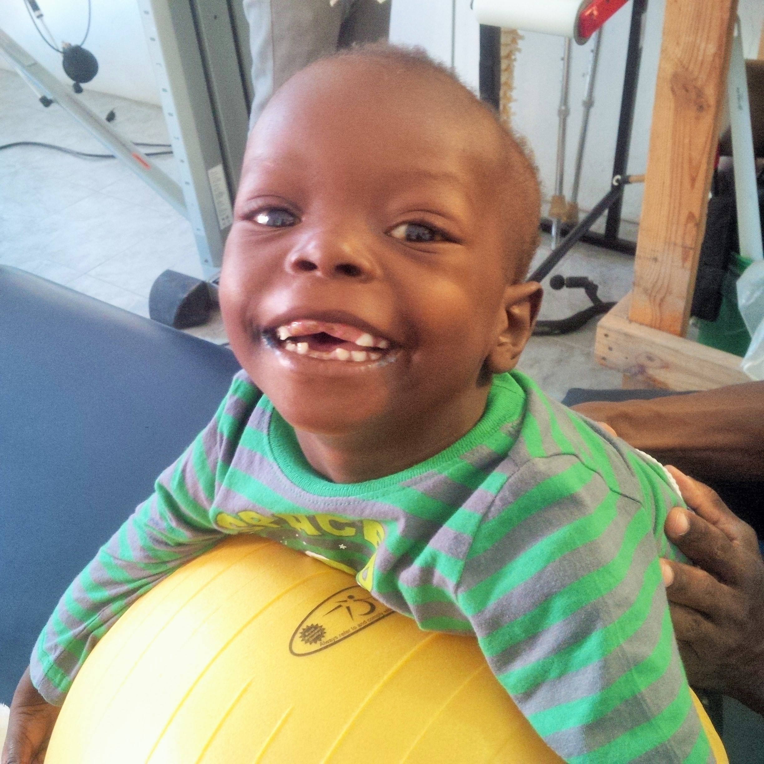 Provide Rehabilitation to 500 children in Haiti