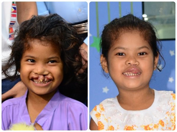 Fund a Life Saving Defibrillator for Kids' Surgery