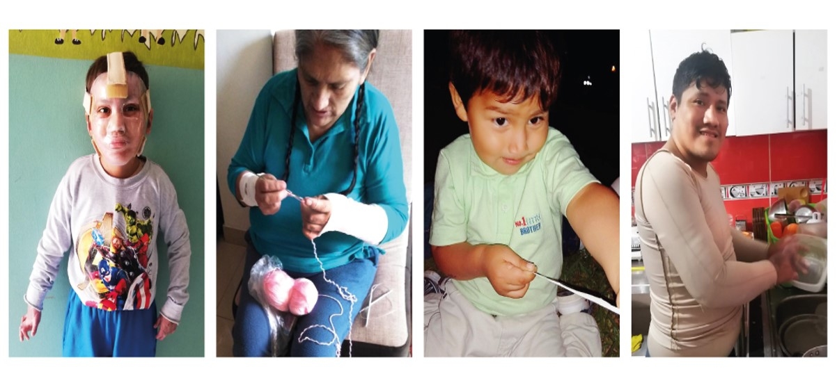 Restoring lives from the tragedy in Lima - Peru