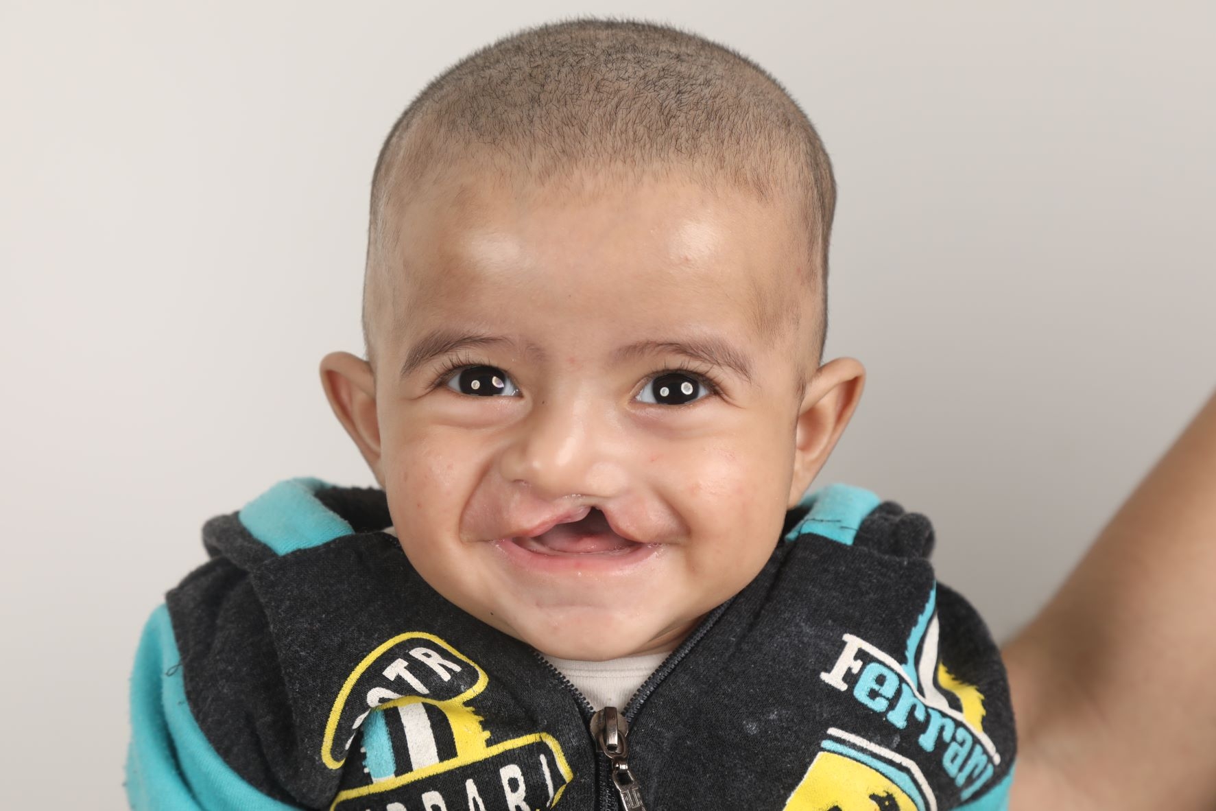 Help 10 Children Born with Cleft in Lebanon/MENA
