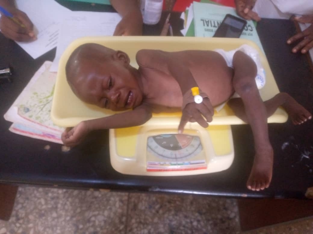 Combat Malnutrition in Nigeria