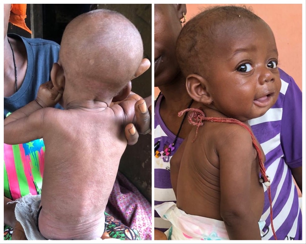 Support orphans and malnourished infants.