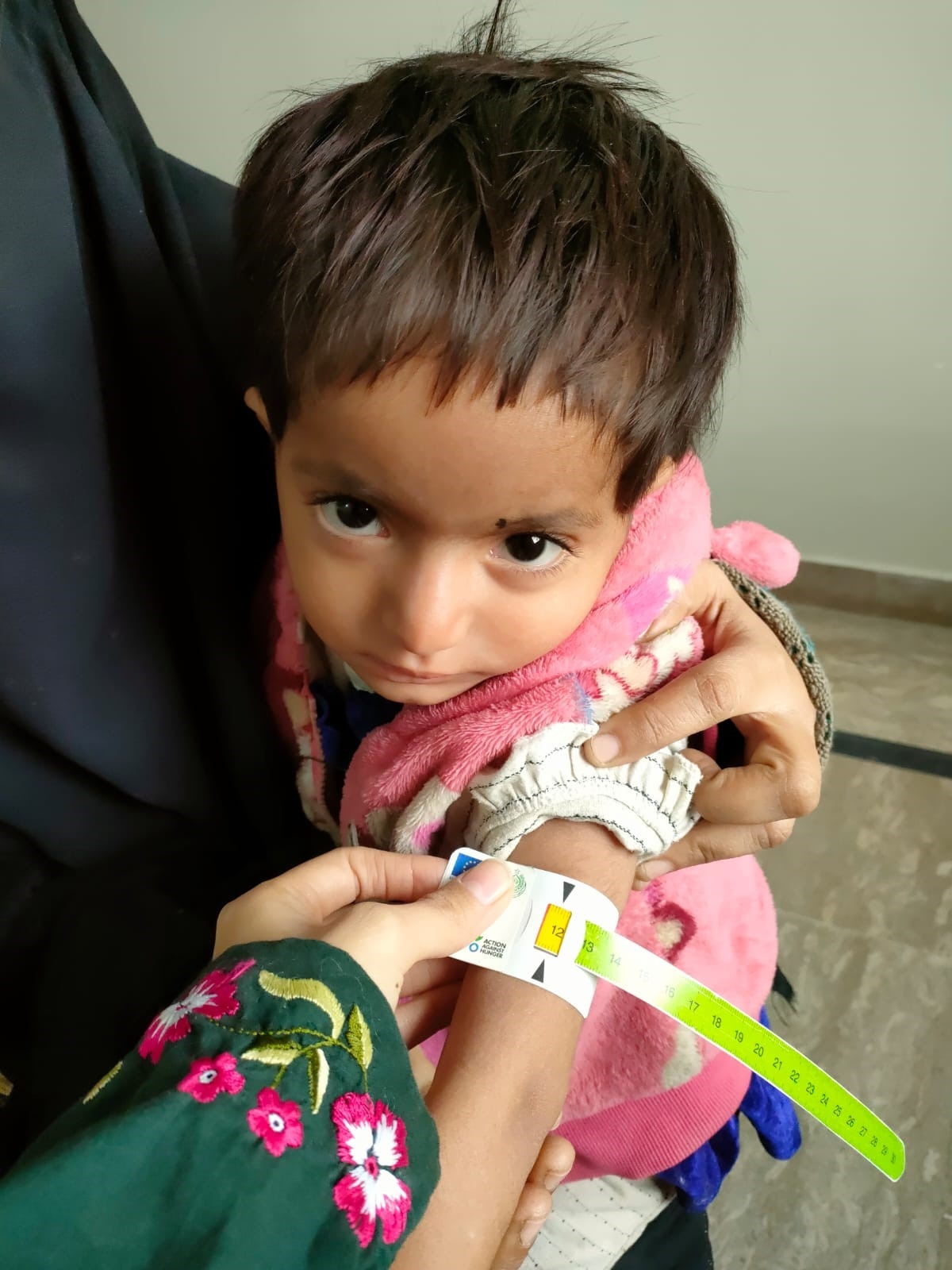 Save 1000 children from Malnutrition in rural Sind