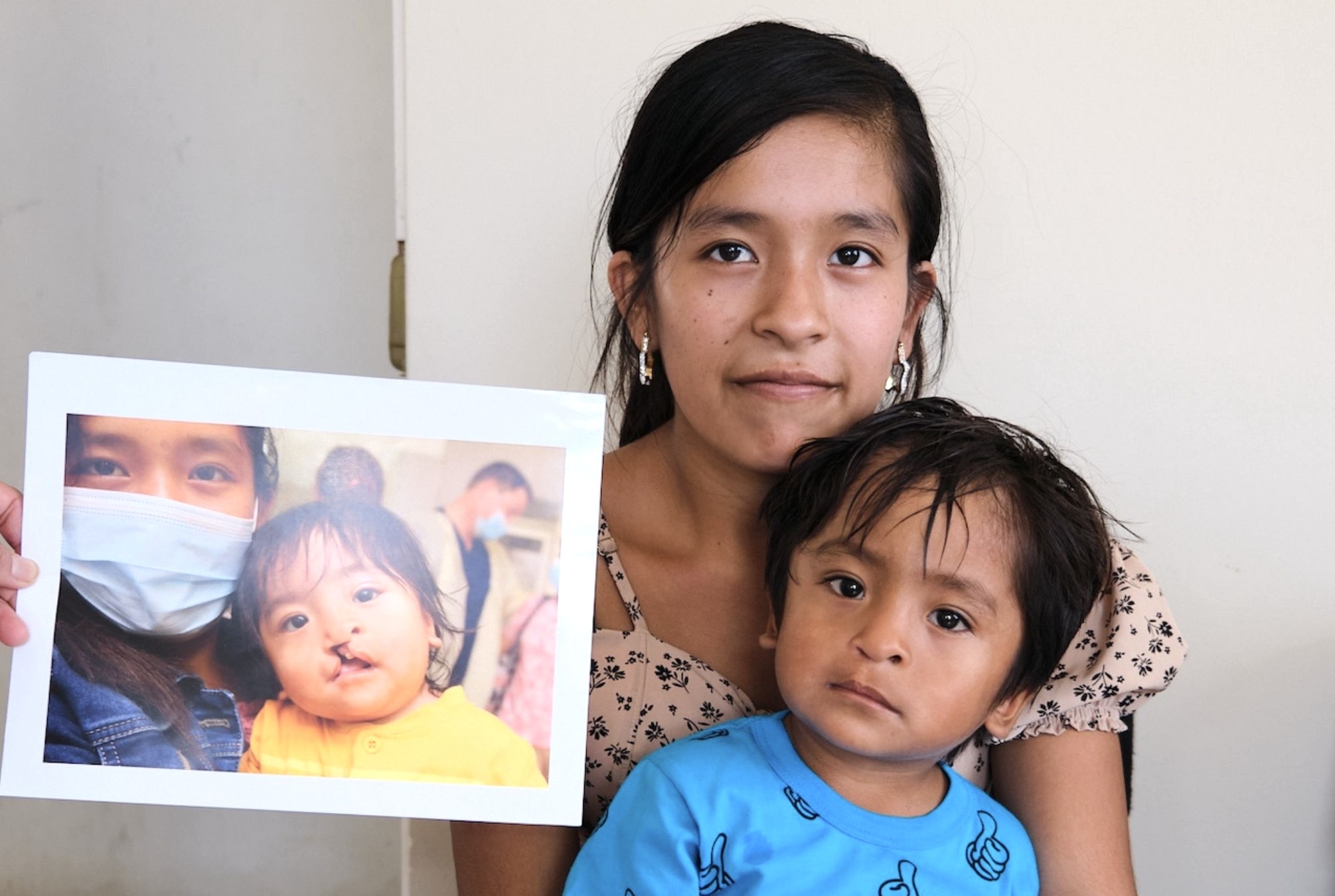 Help 40 more children receive surgery in Peru
