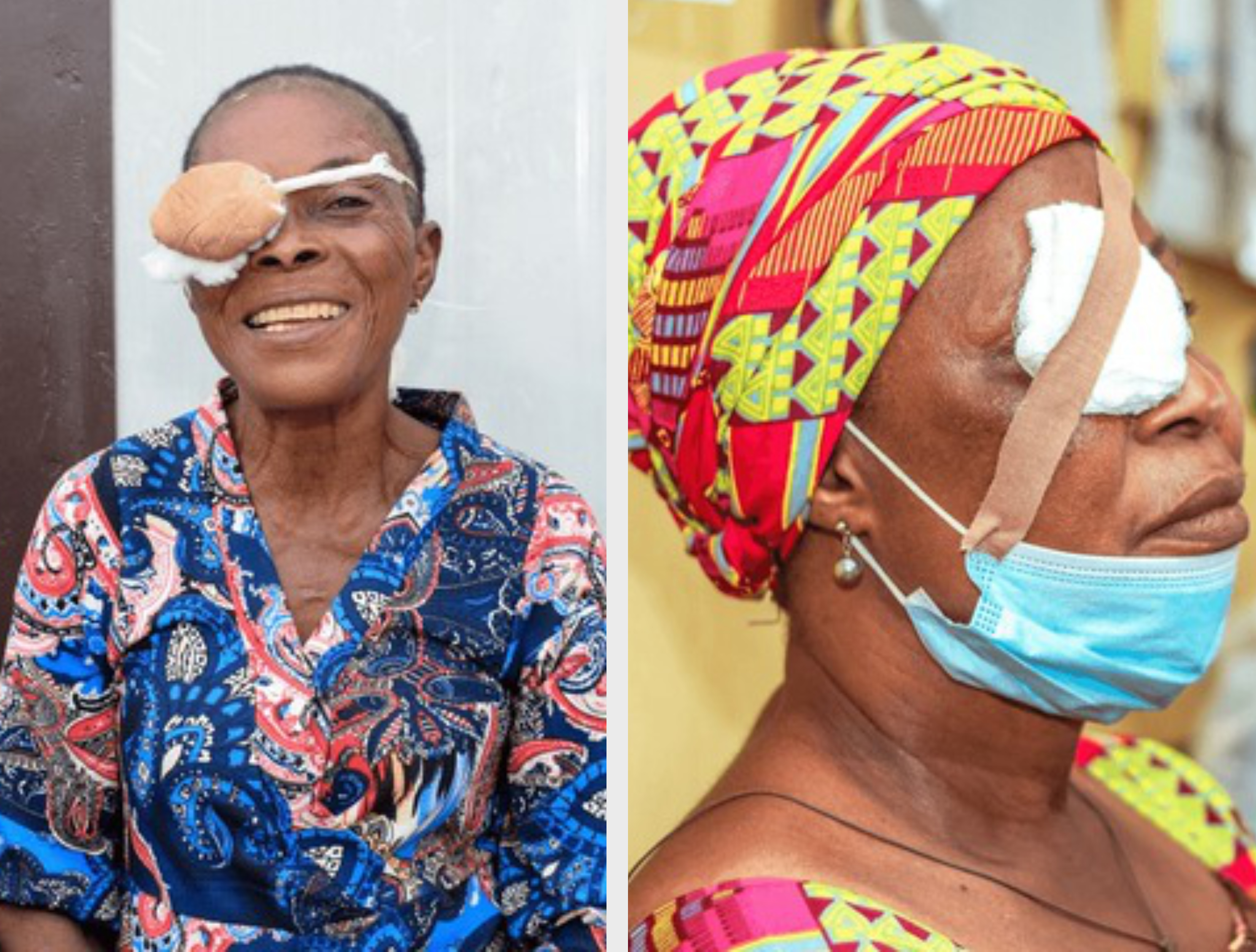 Fund Cataract Surgery for 500 Elderly Nigerians