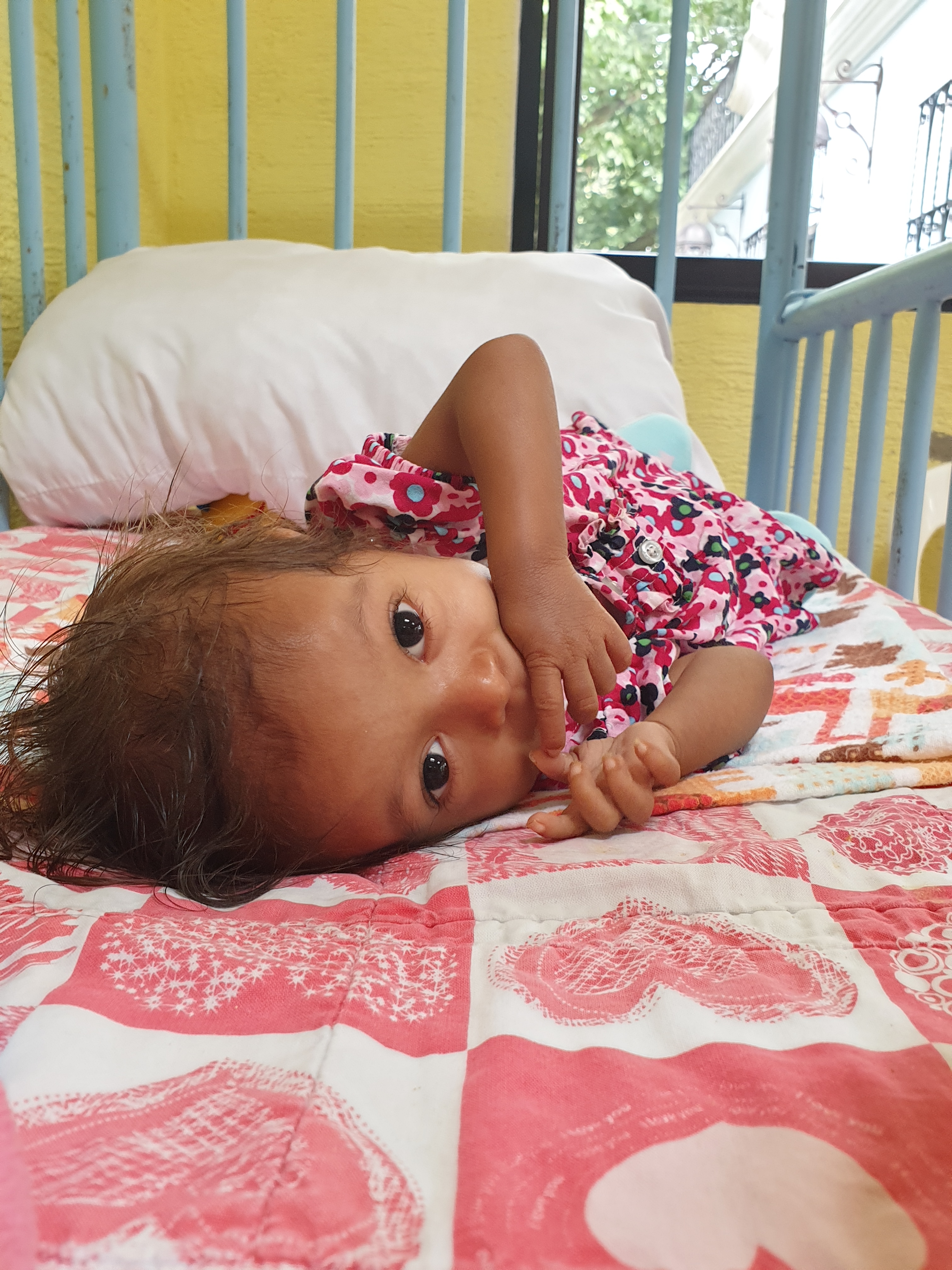 Rescue a Malnourished Child in Guatemala