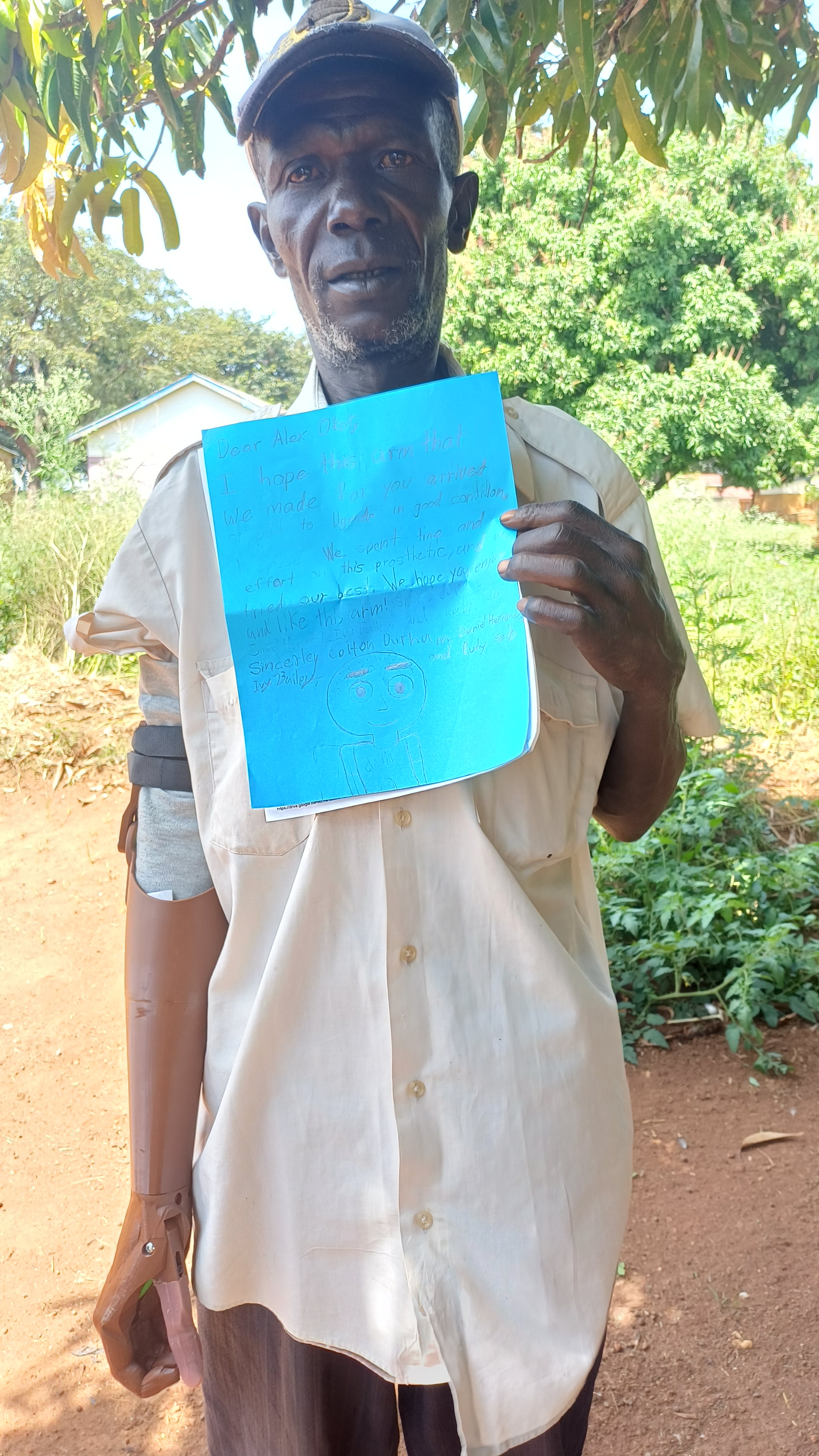 3D Print Upper Limb Prosthetics for 150 in Uganda