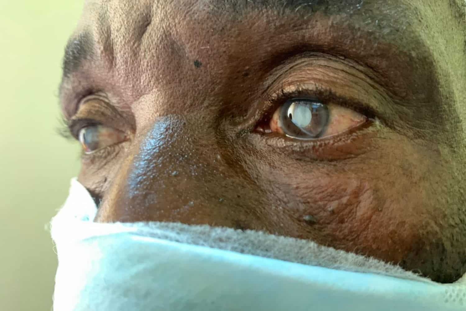 Restore Sight to 500 Nigerians with Cataracts.