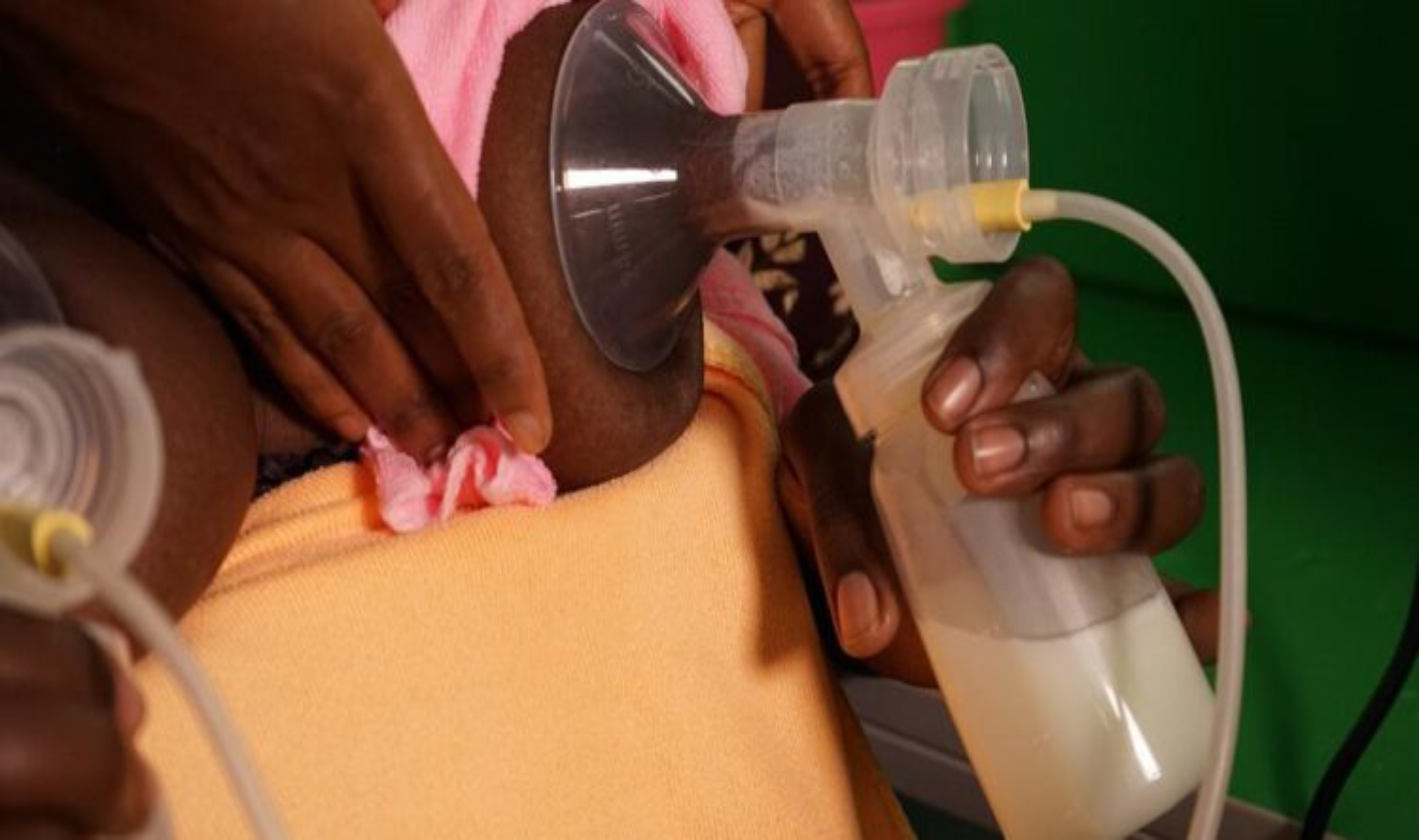 Breast Milk Bank for Mothers Who Lost Both Breast