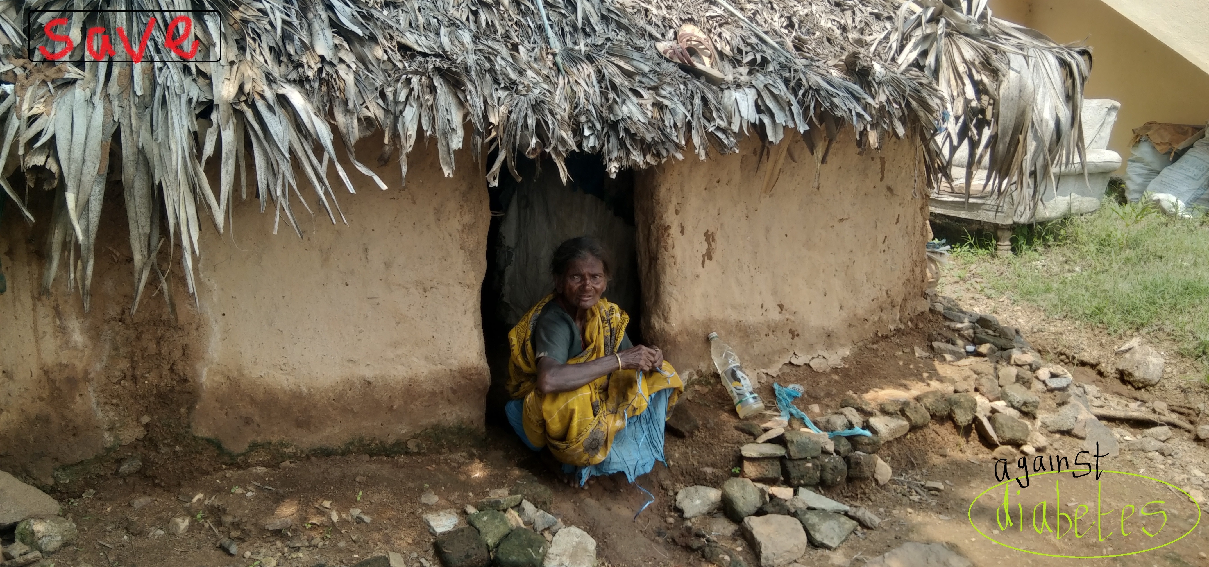 Diabetes Prevention & Control in rural and tribals