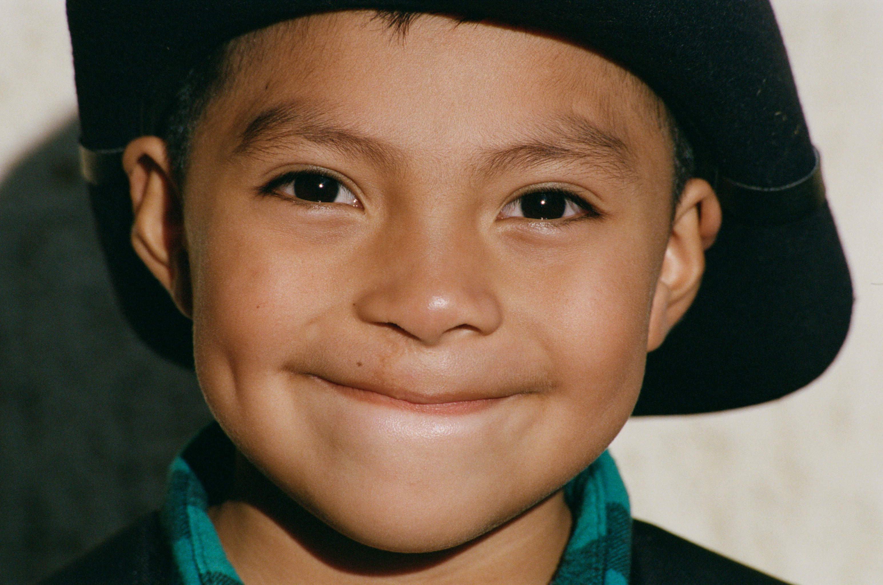 Operation Smile: Improve Surgical Access Globally