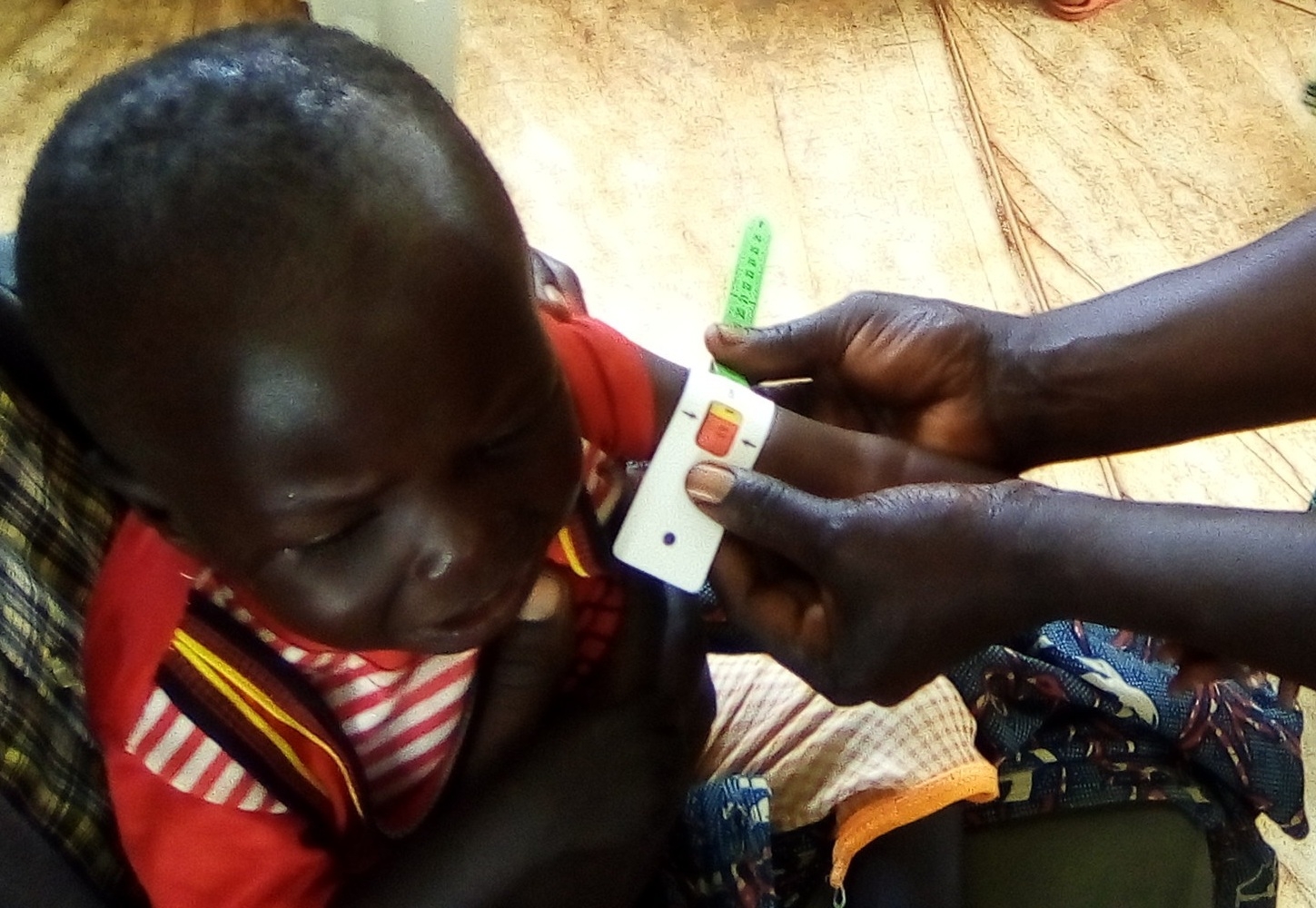 Urgent: Save Malnourished Children in Eastern DRC