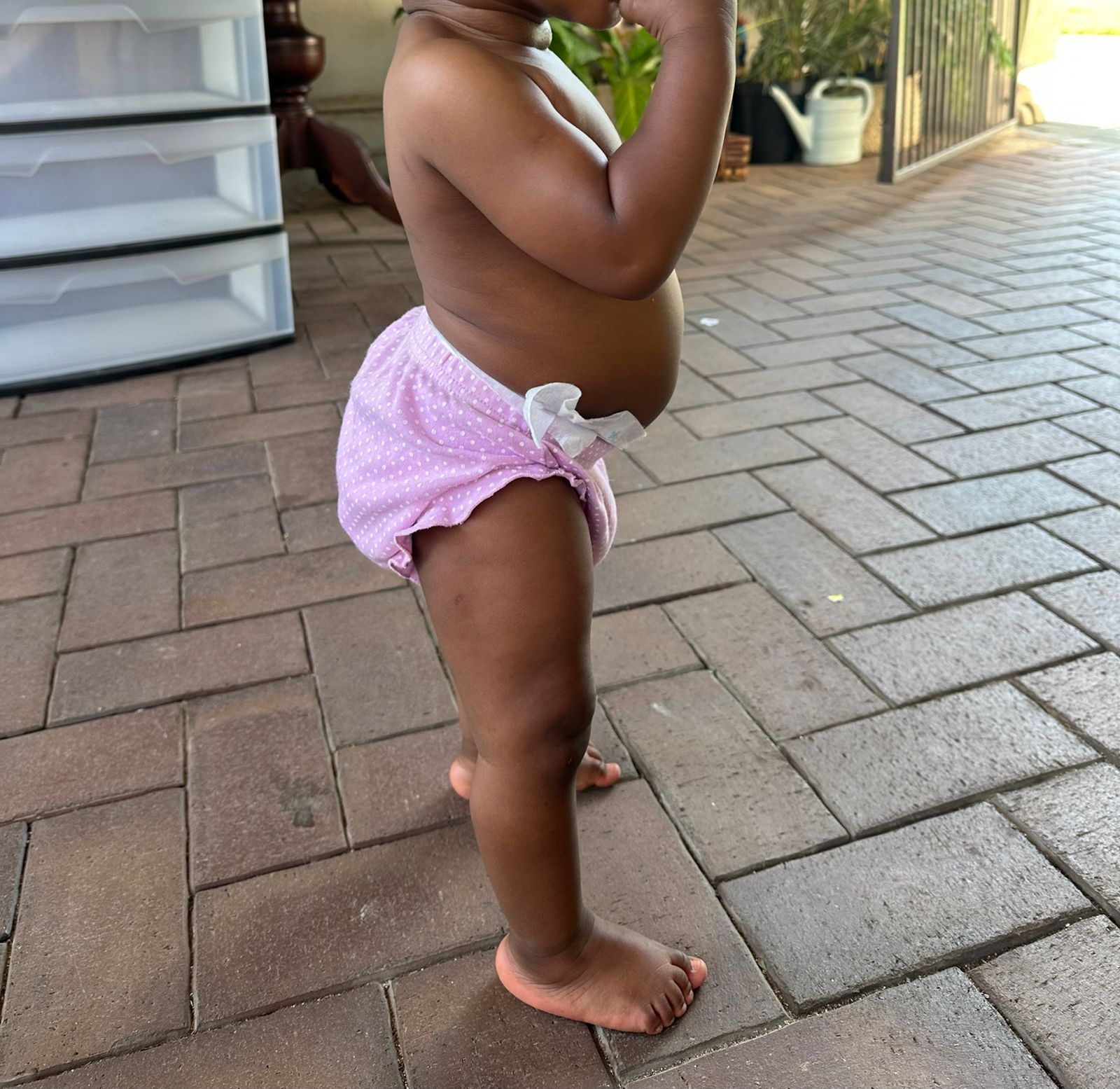 Give Baby 'B' the Gift of Walking Freely