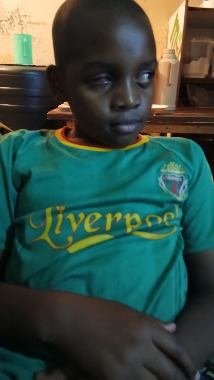 This 10-Yr child needs a Prosthetic Eye