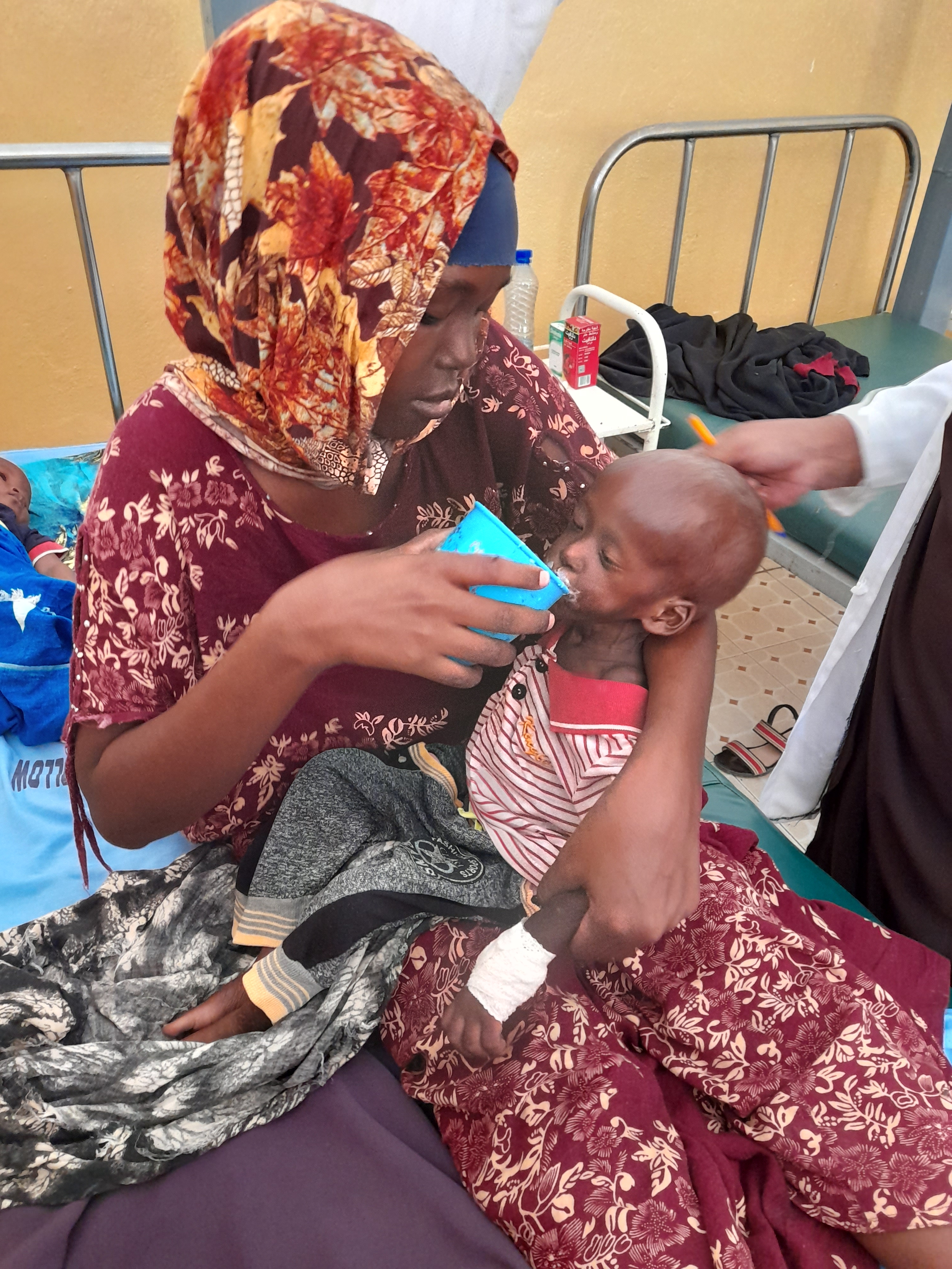 Child Nutrition Crisis Response in Burhakaba.
