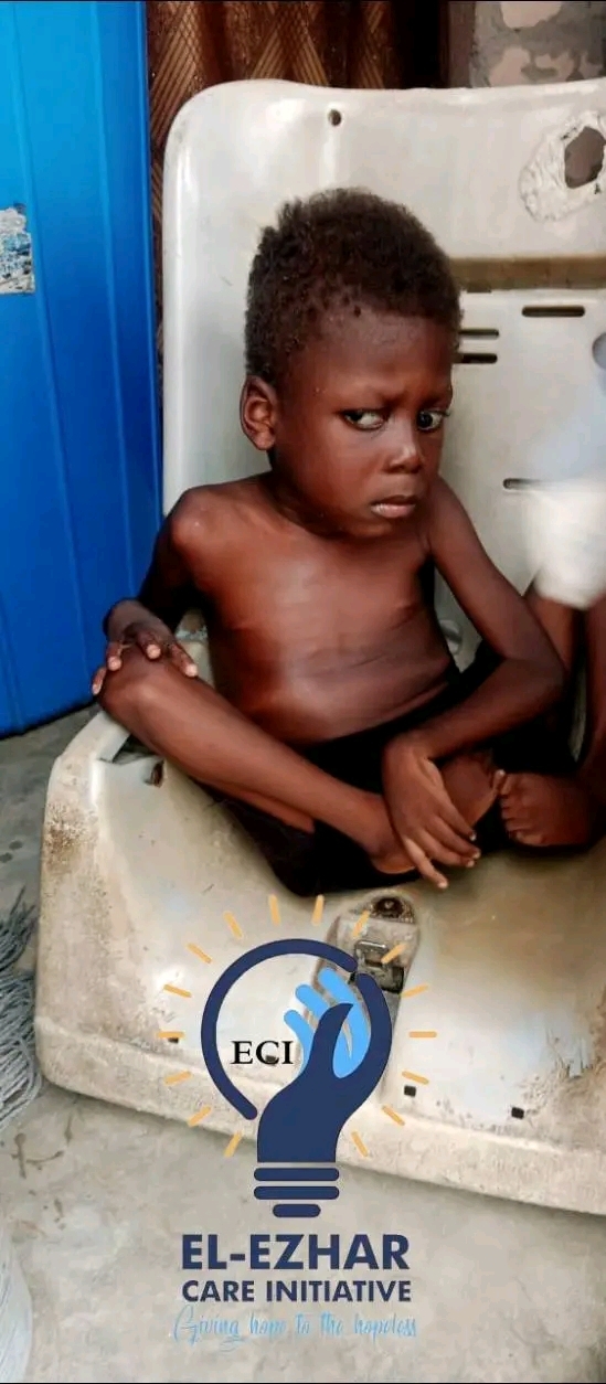 Combating malnutrition and Nutrition Education