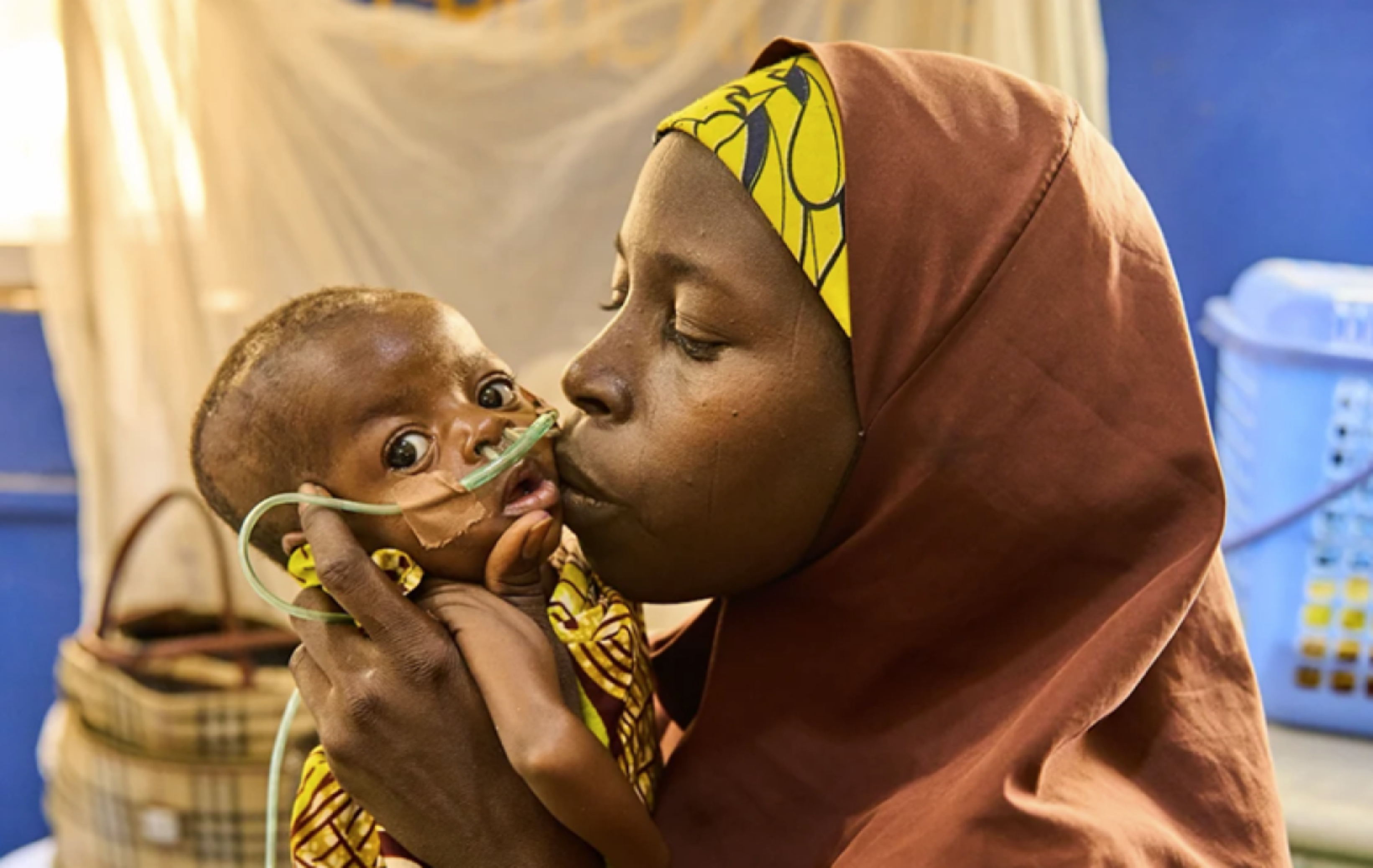 Help Save 100 Nigerian Children from Malnutrition