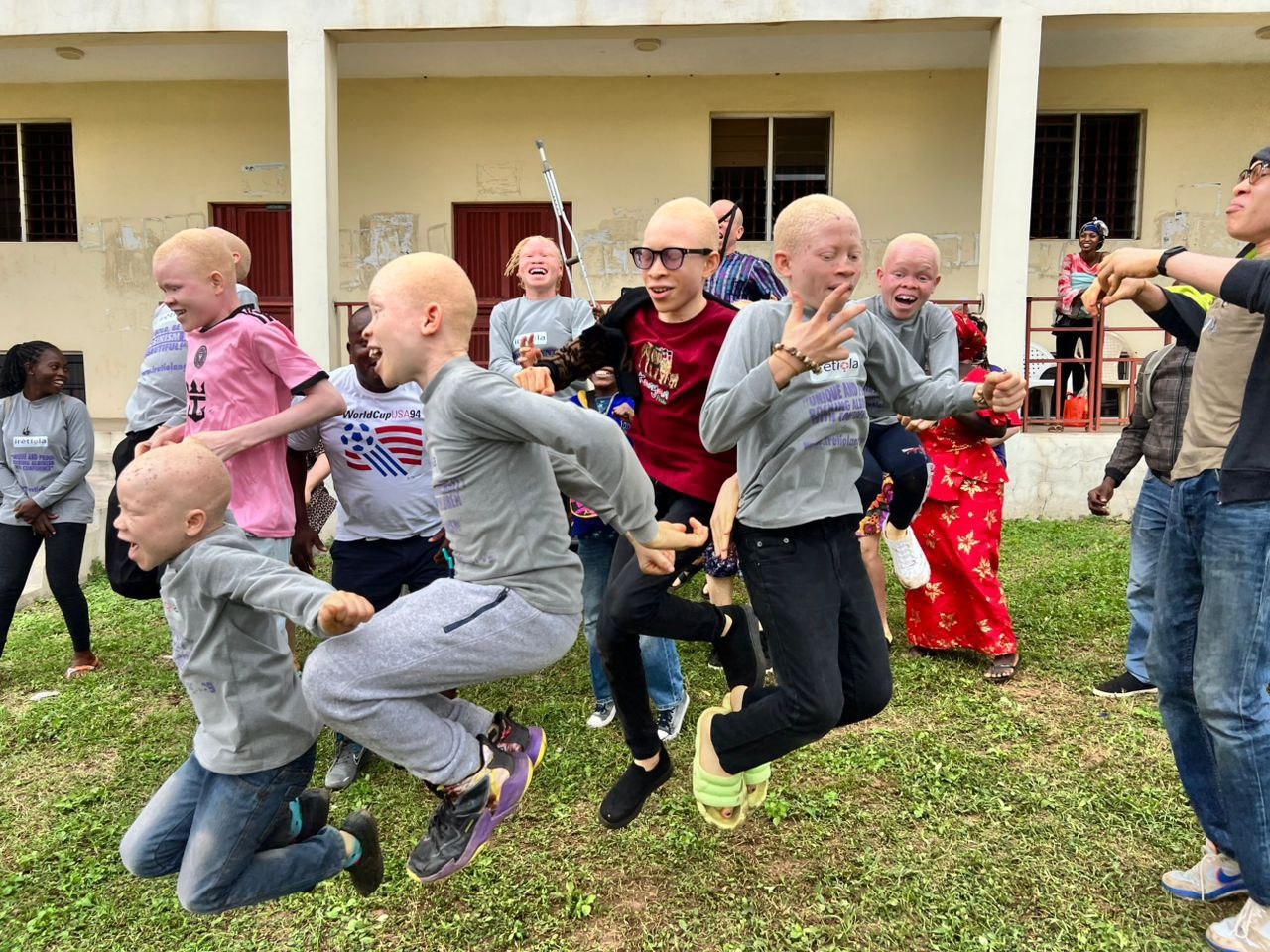 Save 50 Children with Albinism in from Skin Cancer