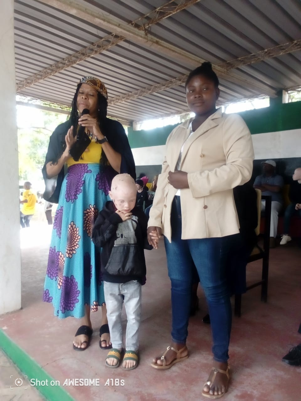 Advance Inclusion for People with Albinism